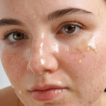 **

A close-up shot of a woman with acne-prone skin gently cleansing her face with a tea tree oil-based cleansing oil, focusing on the healthy skin and the gentle cleansing motion.

**